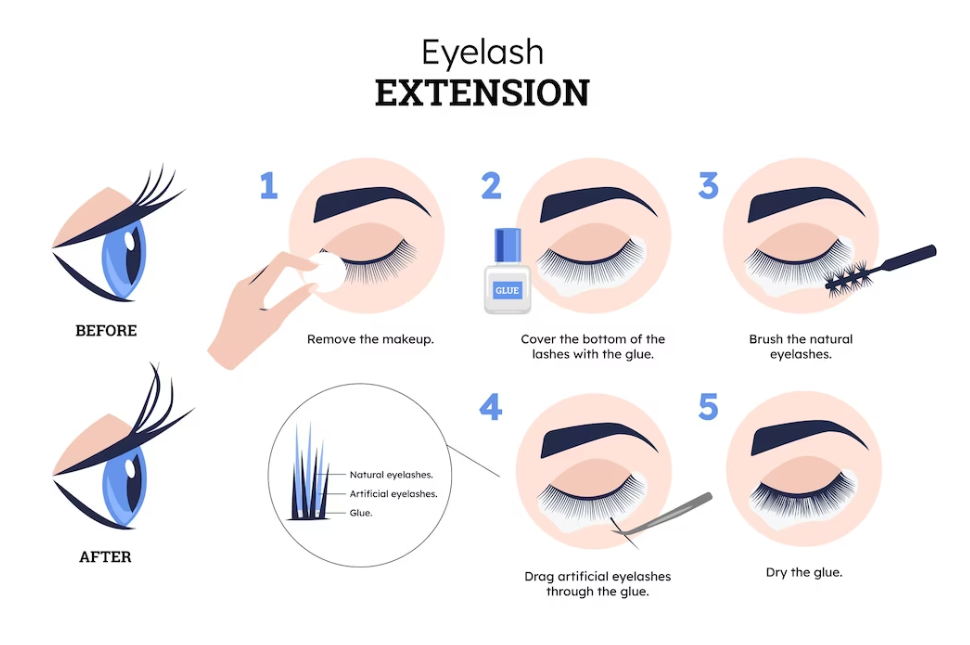 How to treat chemical burn in eye from eyelash extensions